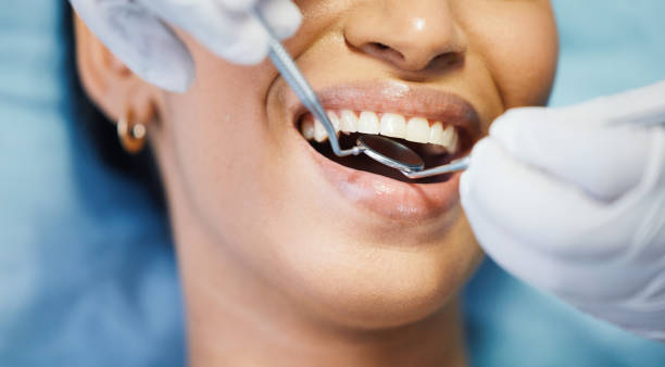 Best Urgent Care for Lost Fillings or Crowns in Sandpoint, ID